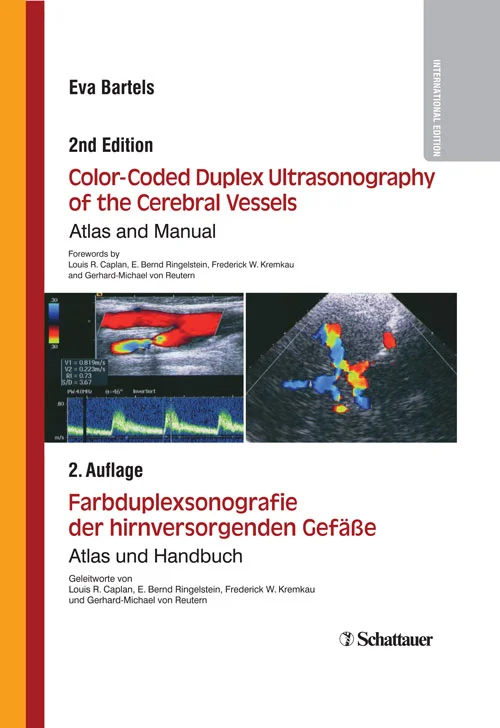 Color-Coded Duplex Ultrasonography of the Cerebral Vessels (2nd Edition)